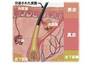 肌断面図