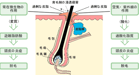 脱毛構造,断面図